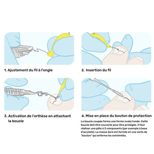 Pack - Fils d'orthonyxie Ortogrip - 6 tailles - Ruck - My Podologie